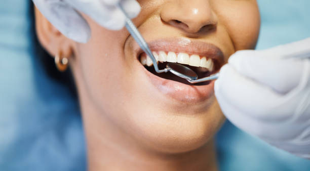 Best Emergency Treatment for Dental Infections or Abscesses in East Shoreham, NY